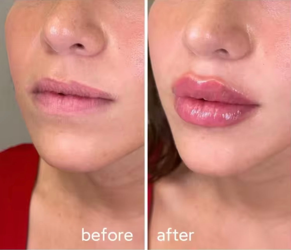 Reshape your lips now